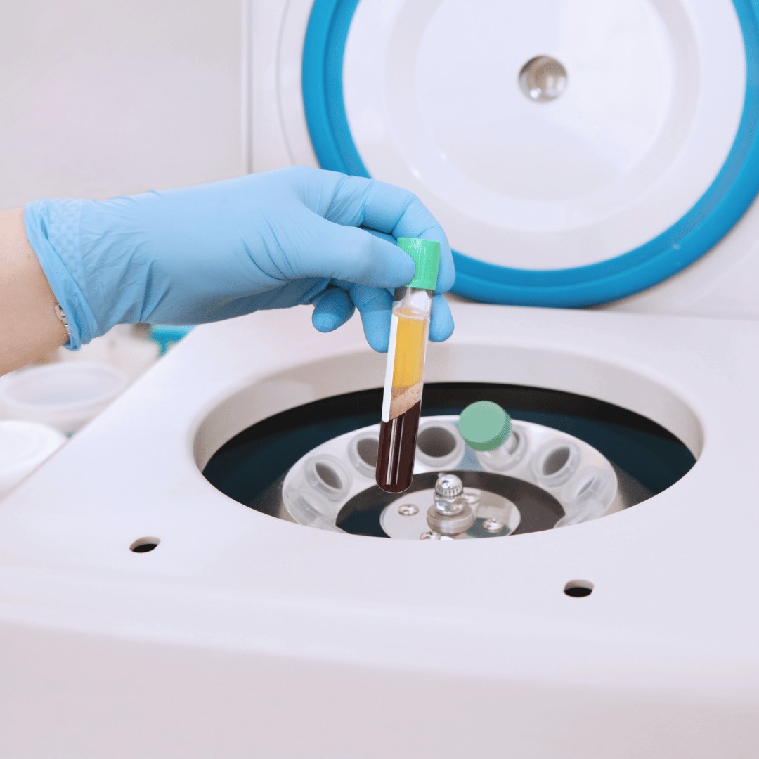 PRP centrifuge - plasma scheiding