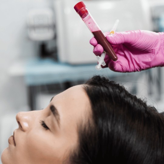 PRP haarbehandeling